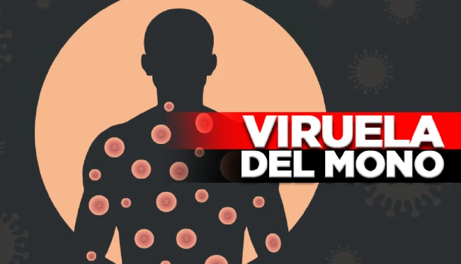 Salud reporta el décimo caso de viruela del mono en El Salvador
