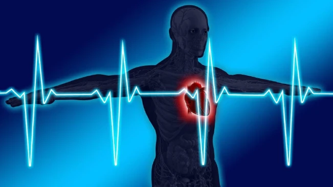 Hace 40 años un equipo médico logró el primer trasplante permanente de corazón artificial