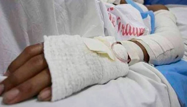 Salud atendió a 265 quemados por pólvora