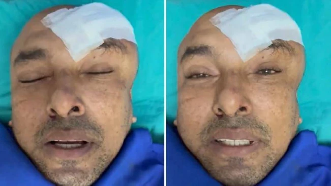 Omar Angulo sufre lesiones contundentes en accidente de tránsito