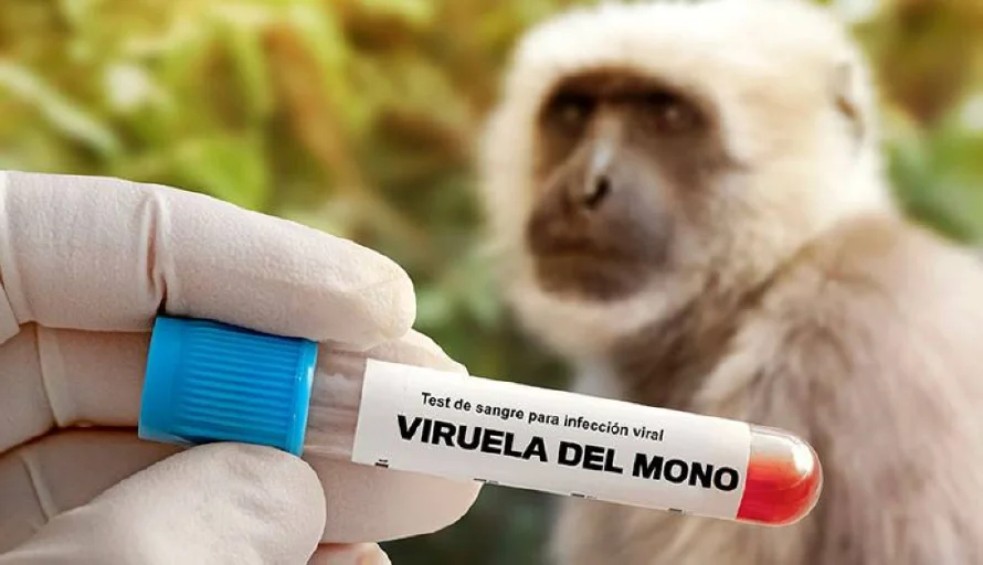 China informa de cinco casos de la nueva variante dela viruela del mono