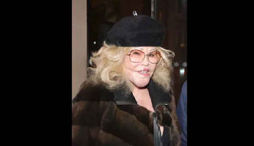 Fallece Jocelyn Wildenstein, figura de la alta sociedad neoyorquina conocida como la "mujer felina"