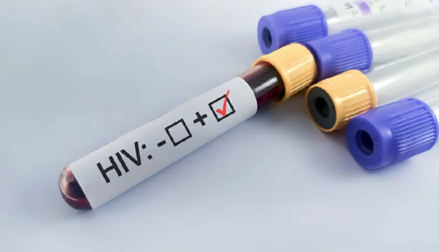 Descartan aumento de casos de VIH en El Salvador