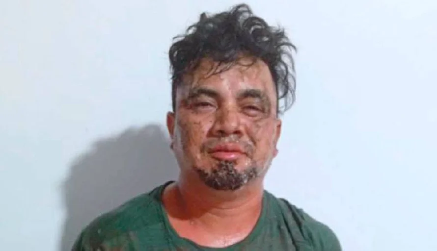 PNC detiene a sujeto que apuñaló a su compañera de vida embarazada