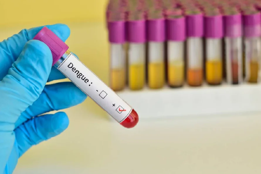Ministerio de Salud confirma más de 50 casos de dengue en el 2025
