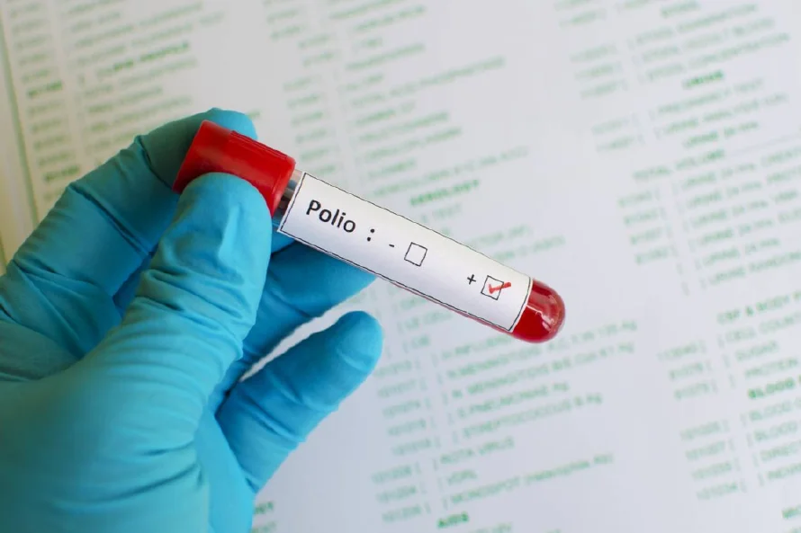 Declaran emergencia nacional en Papúa Nueva Guinea por un brote de polio