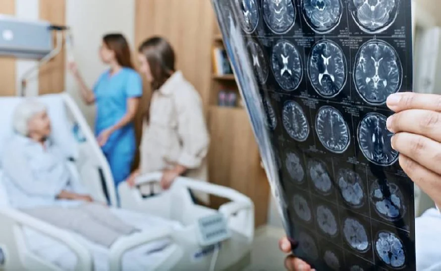 Las claves del primer análisis de sangre aprobado en EEUU para detectar Alzhéimer