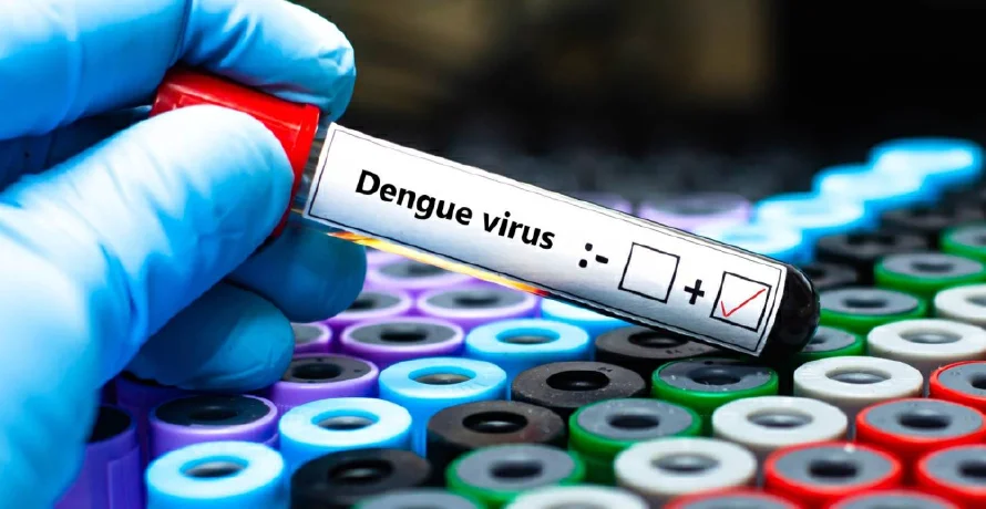 Salud registra 70 casos positivos de dengue y más de 2,000 sospechosos en cinco meses del 2025