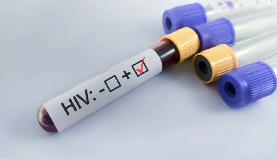 EE.UU. aprueba la primera inyección preventiva para el VIH aplicada cada seis meses
