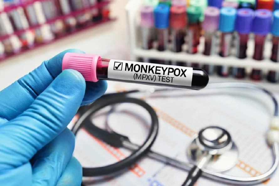 África reporta descenso sostenido de casos de mpox, según la Unión Africana