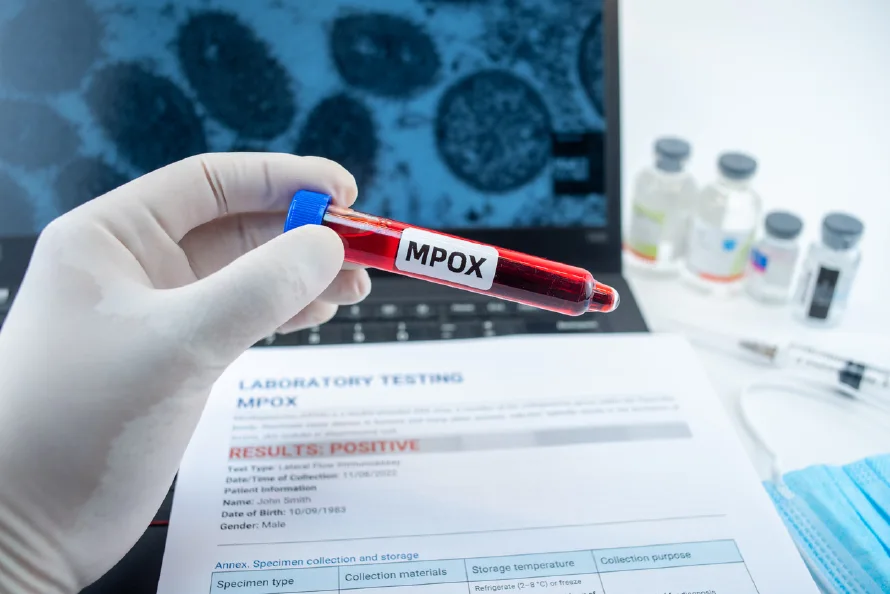 Los casos de mpox siguen a la baja en África, pero el continente no cuenta con más vacunas