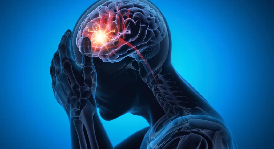 Los infartos cerebrales impactan a mexicanos cada vez más jóvenes, alerta un especialista