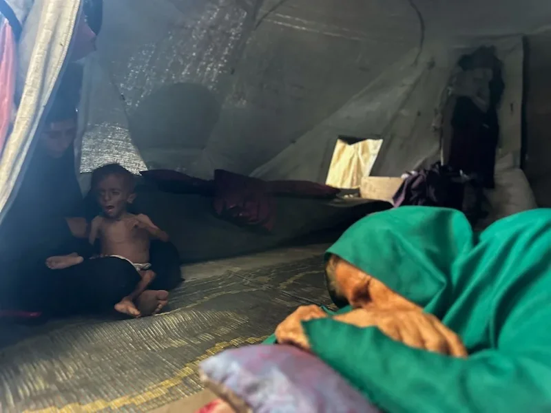 Enfermos y desnutridos, los niños de Gaza que Israel llama fake news también pasan hambre