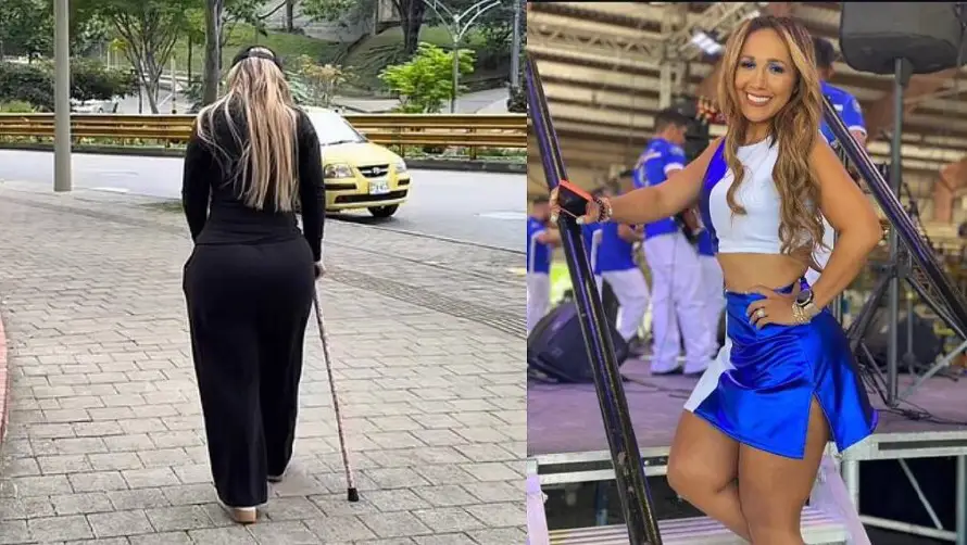 Elena Villatoro habla de su lucha contra el lipedema y busca crear conciencia