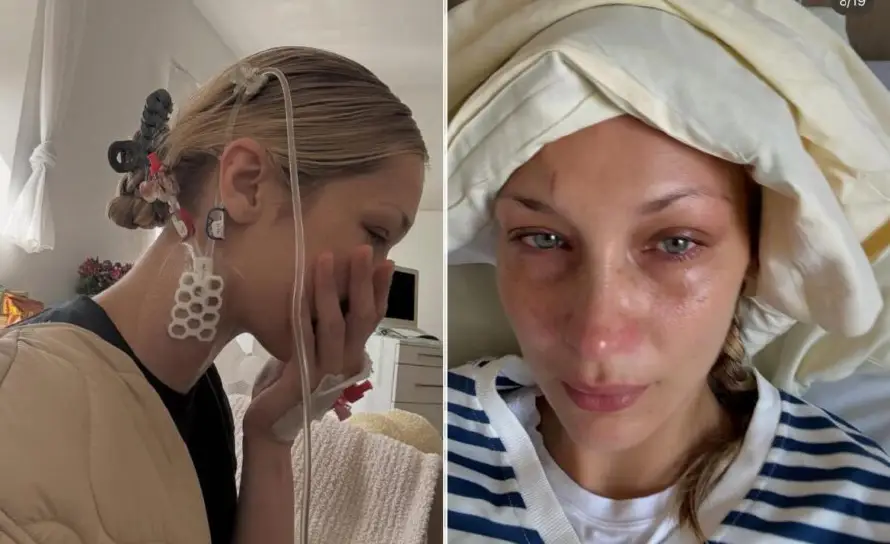 Bella Hadid comparte su desgarrador estado por la enfermedad de Lyme