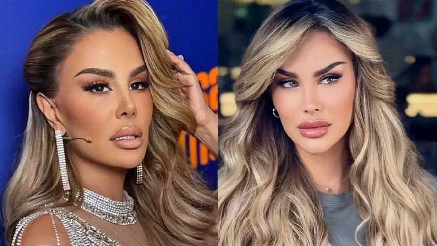 Ninel Conde y la escandalosa cirugía para cambiar el color de sus ojos
