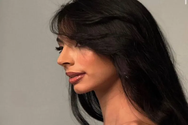 Giulia Zanoni reaparece tras someterse a retoque estético rumbo a Miss Universo 2025