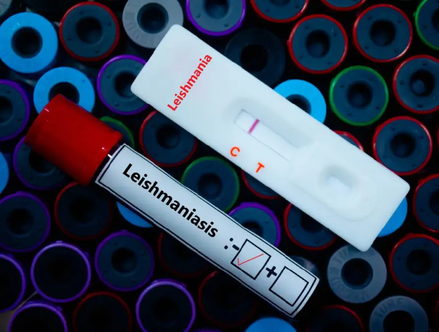 Salud registra 10 casos de Leishmaniasis en El Salvador durante 2025