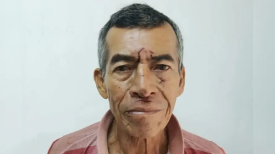 Arrestan a conductor con 183 grados de alcohol señalado de colisionar con otro vehículo en Santo Tomás