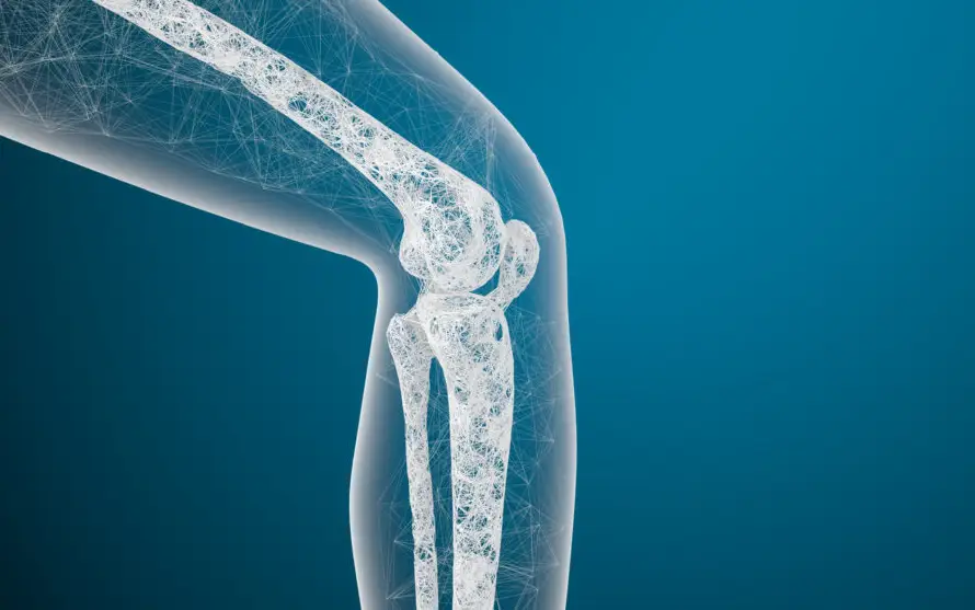 Unas 500 millones de personas en el mundo padecen osteoporosis sin saberlo