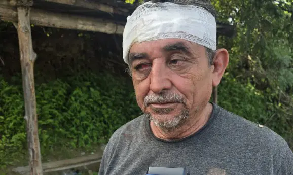 Arrestan a conductor ebrio tras provocar un accidente en Chalatenango