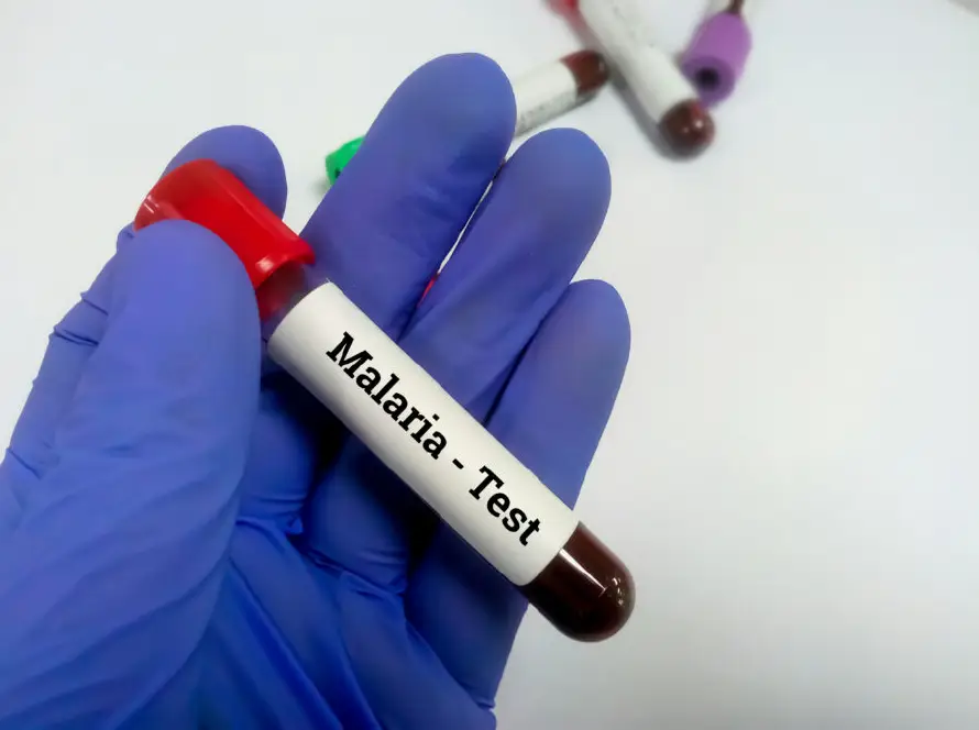 Salud confirma 107 casos de malaria, pero descarta casos autóctonos