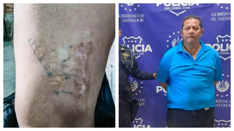 Arrestan a pandillero de la MS-13 que trató de ocultar tatuajes quemándolos