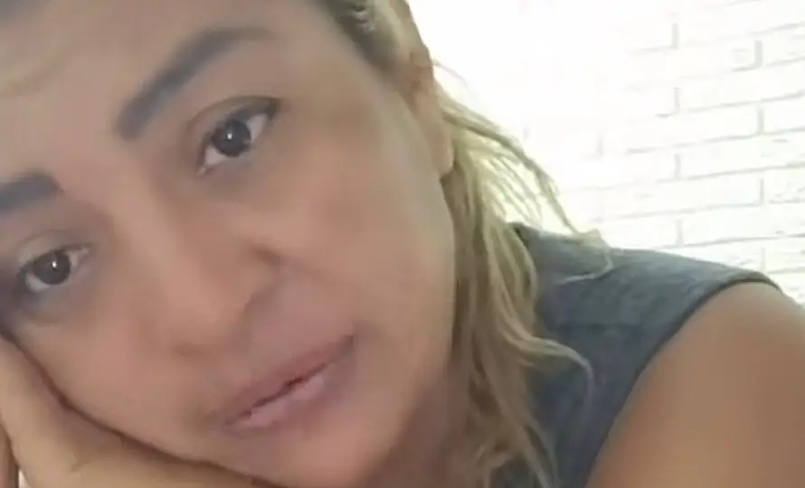 Yanira Berríos explica el lamentable origen de su cicatriz en la frente