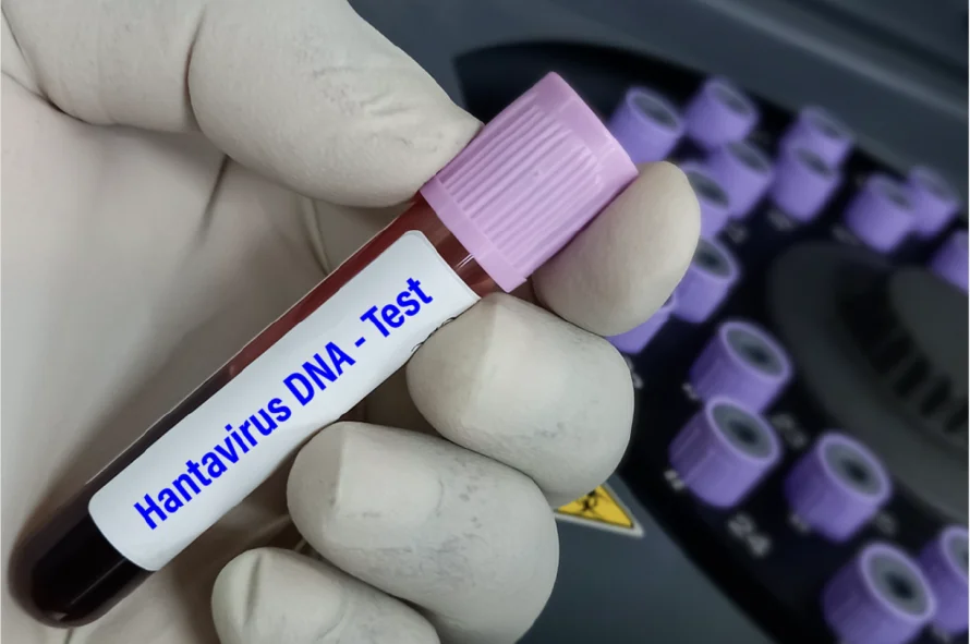 La OMS eleva a seis los casos confirmados de hantavirus tras el positivo de un contagio sospechoso