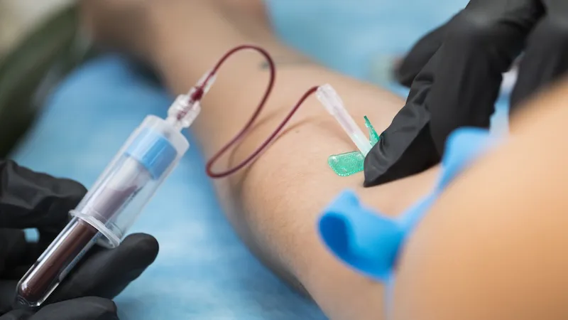 Análisis de sangre detectaría Alzheimer años antes de síntomas