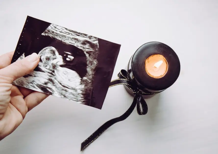 El luto invisible: la realidad médica y psicológica de la pérdida gestacional
