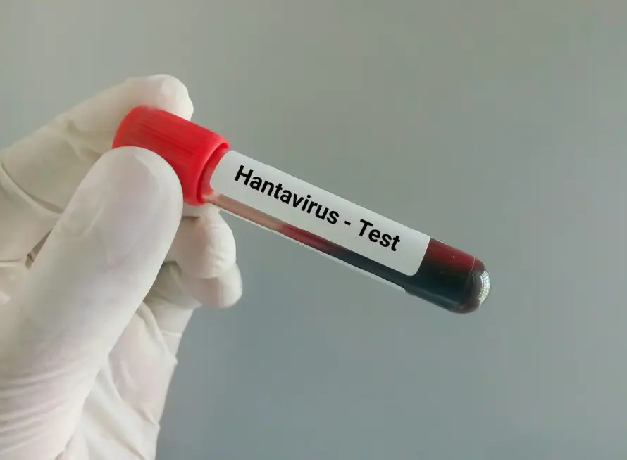 Responsable de lucha contra hantavirus en el Pasteur: el interés de farmacéuticas es clave