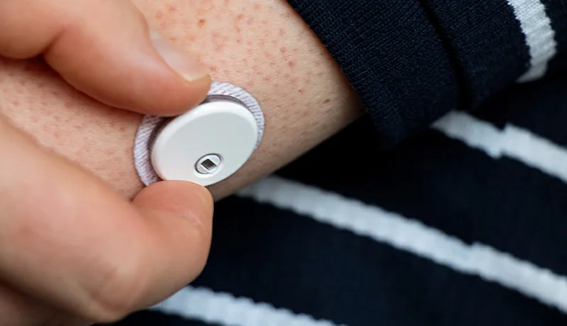 Un sensor de glucosa digital pone fin a los pinchazos para los diabeticos en El Salvador