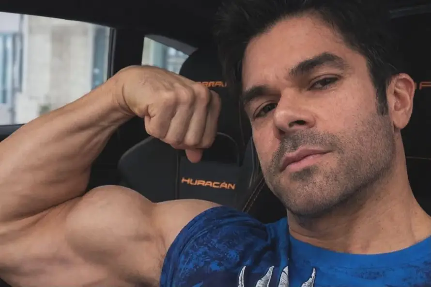 Jerry Rivera muestra su brazo tras una operación por fractura de tendón