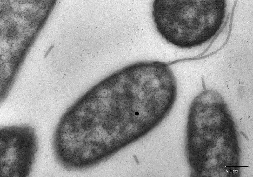 Florida registra la primera muerte de 2026 en EE.UU. por una bacteria carnívora en el mar