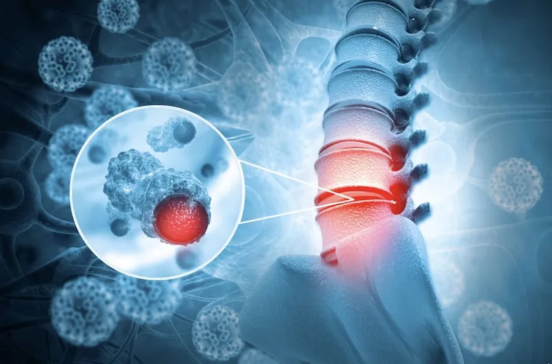 Universidad de Tel Aviv prepara el primer implante de médula espinal artificial en humanos