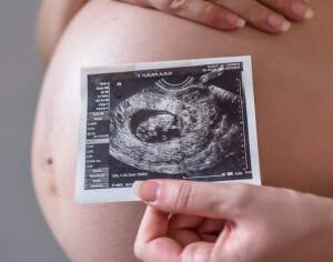 Identifican una proteína clave en el desarrollo de la placenta y el crecimiento fetal