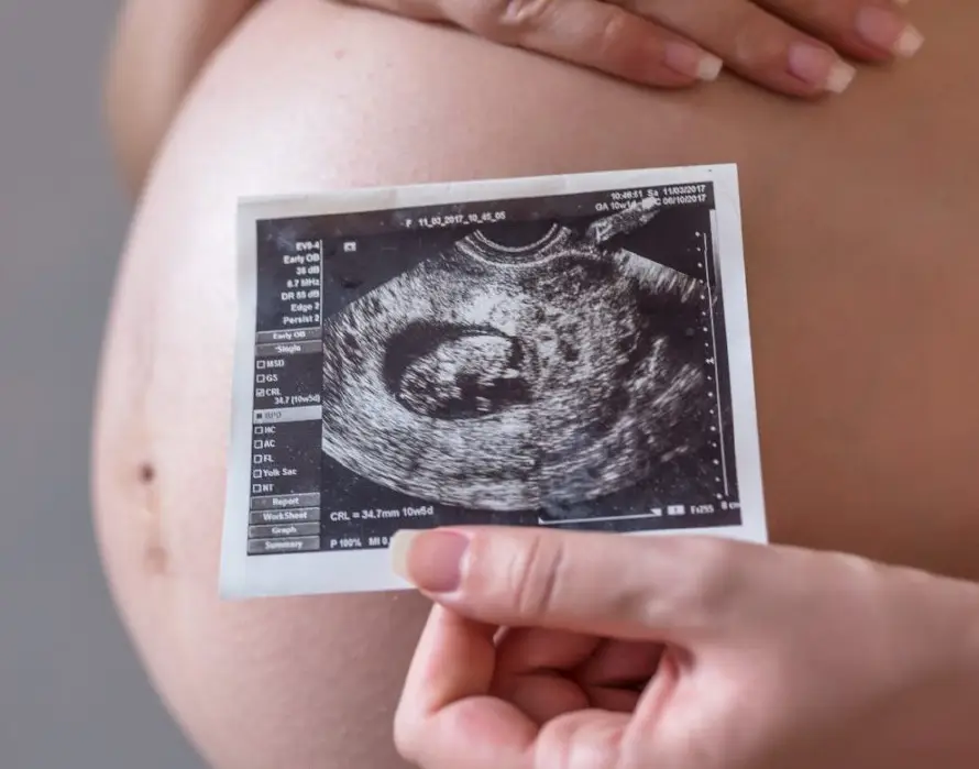 Identifican una proteína clave en el desarrollo de la placenta y el crecimiento fetal