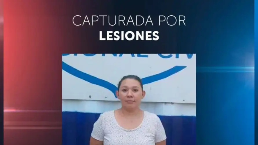 Detienen a una mujer señalada de atacar con un cuchillo a su compañero de vida en Santa Ana