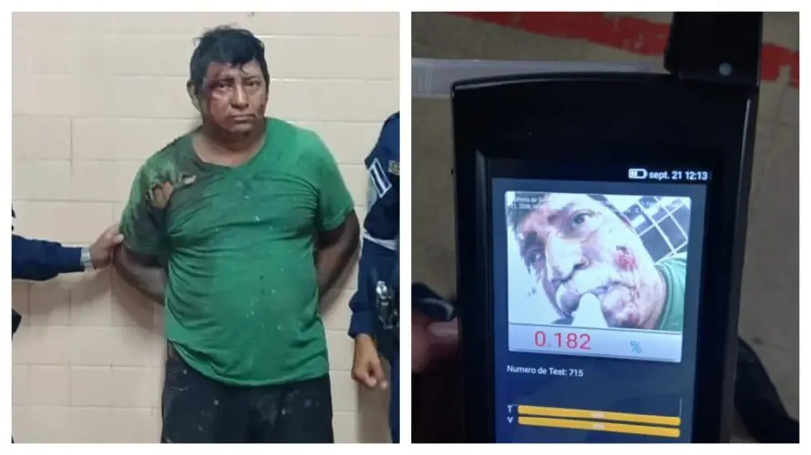 Motociclista con 182 grados de alcohol es arrestado tras atropellar a peatón en Morazán Sur