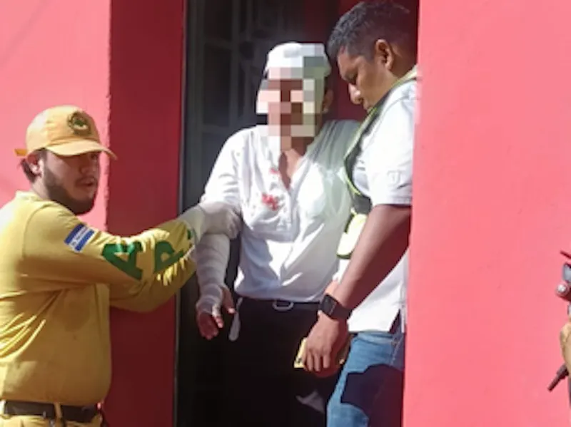 Tres personas quemadas en explosión de gas en Sonsonate