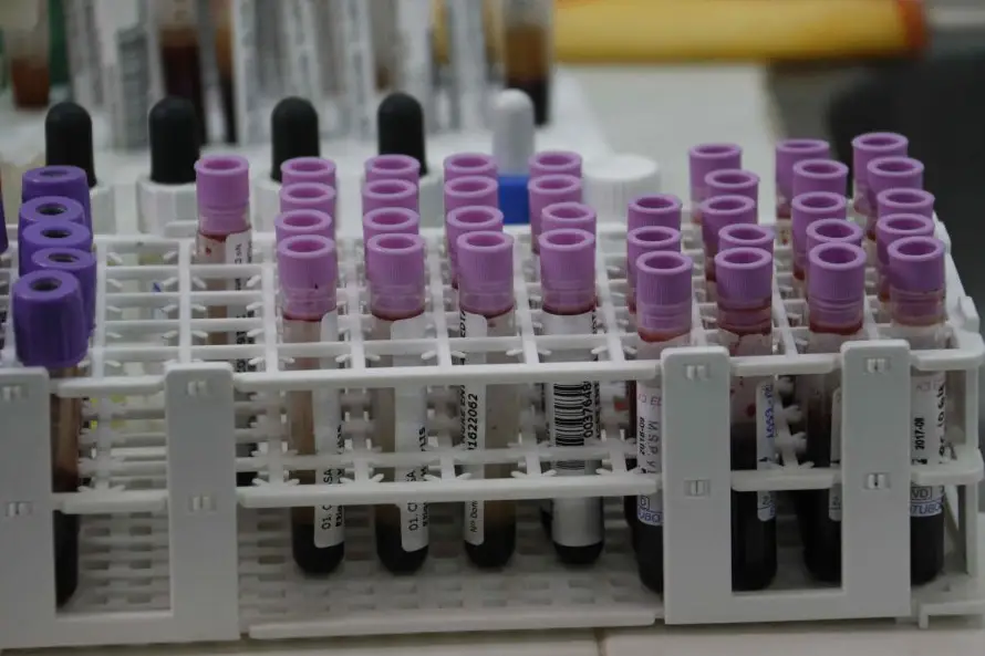 IA y el aprendizaje automático ayudarían a detectar a personas en riesgo de sufrir cáncer